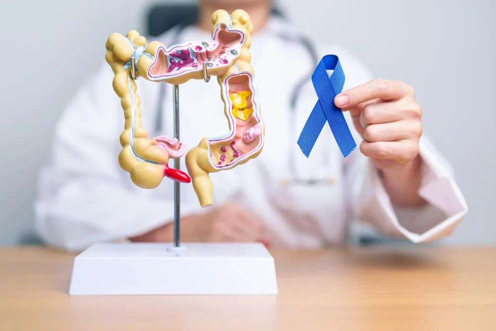 Cirugía oncológica de colon y recto en CDMX: manejo integral del cáncer colorrectal